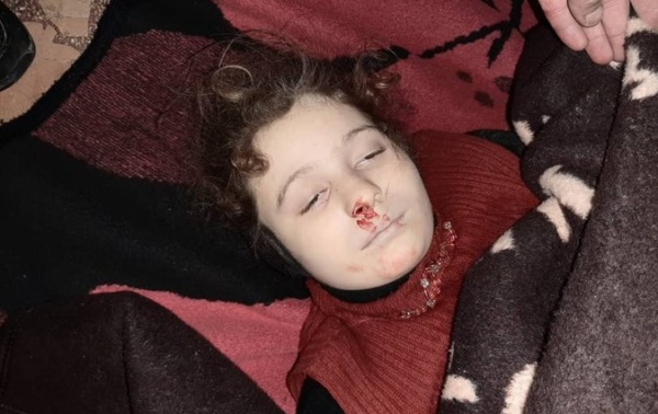 One of the children killed by Russia-regime bombing of Sarmin, Idlib Province, northwest Syria, January 1, 2020